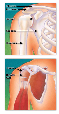 shoulder surgery